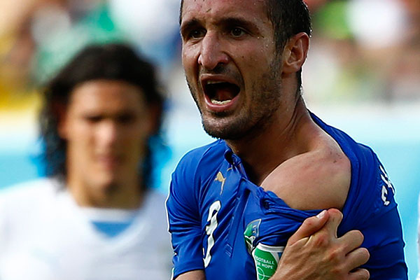 Защитник сборной Италии Джорджо Кьеллини демонстрирует мексиканскому судье Марко Родригесу укушенное плечо.