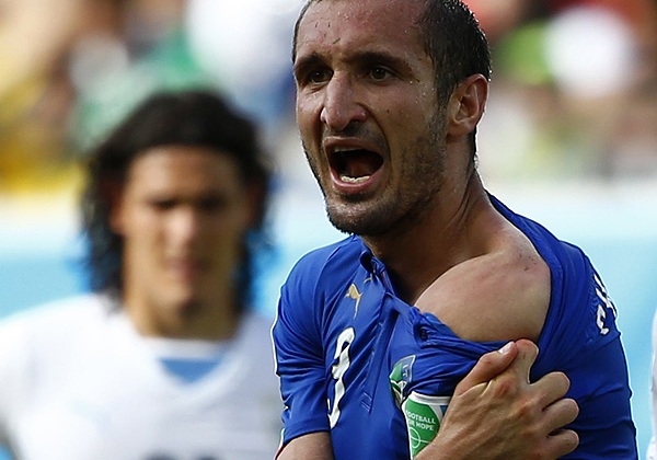 Защитник сборной Италии Джорджо Кьеллини показывает следы зубов уругвайского нападающего Луиса Суареса.