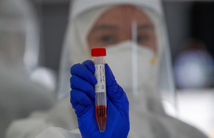 Число жертв коронавируса в мире превысило 233 тысячи человек Число жертв коронавируса в мире превысило 233 тысячи человек