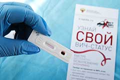 Эпидемиологи констатировали рост числа ВИЧ-инфицированных в России